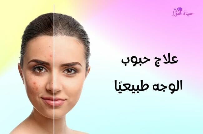 علاج حبوب الوجه طبيعيًا
