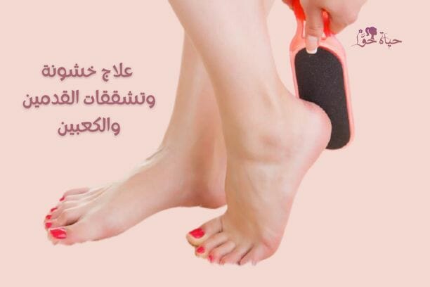 علاج خشونة وتشققات القدمين والكعبين Treatment of roughness and cracks of the feet and heels