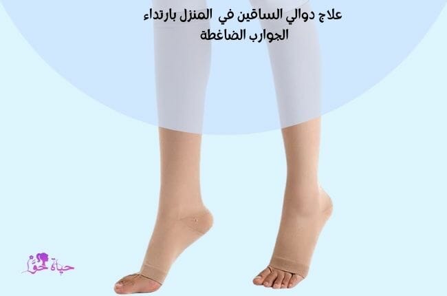 علاج دوالي الساقين بالجوارب الضاغطة