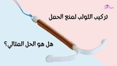 تركيب اللولب لمنع الحمل Insertion of an IUD to prevent pregnancy