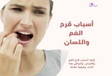 أسباب قرح الفم واللسان Causes of mouth and tongue ulcers