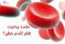 متى يكون فقر الدم خطير؟