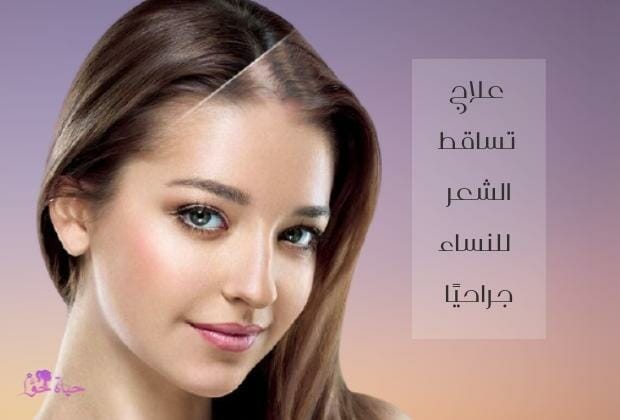 علاج تساقط الشعر للنساء جراحيا