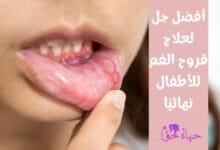 أفضل جل لعلاج قروح الفم للاطفال (Best mouth sores gel for kids)