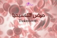 مرض الثلاسيميا Thalassemia