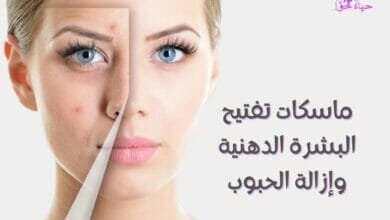 ماسكات لتفتيح البشرة الدهنية وإزالة الحبوب Masks to lighten oily skin and remove pimples