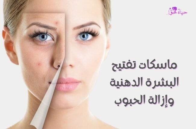 ماسكات لتفتيح البشرة الدهنية وإزالة الحبوب Masks to lighten oily skin and remove pimples