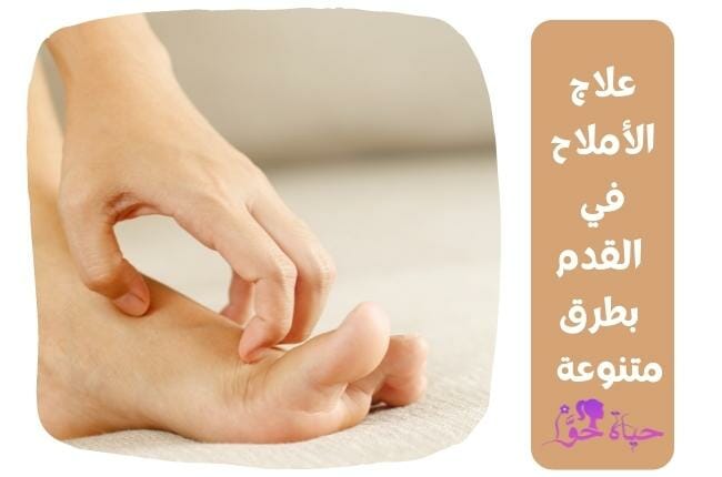علاج الأملاح في القدم (foot salt treatment)