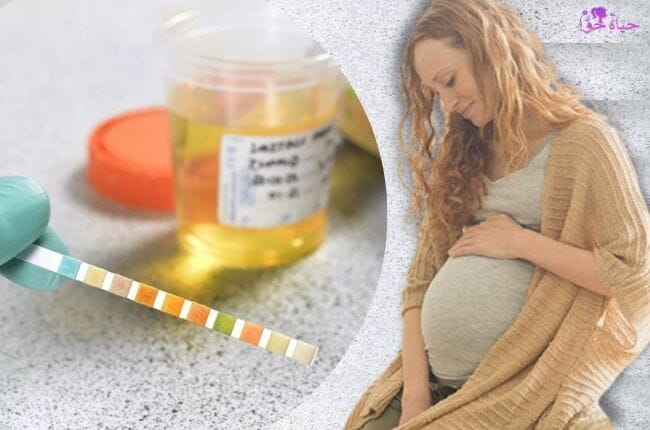 قراءة تحليل البول للحامل