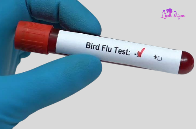 تشخيص مرض انفلونزا الطيور