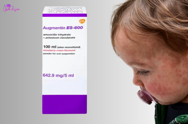 جرعة أوجمنتين شراب للاطفال وآثارها الجانبية
