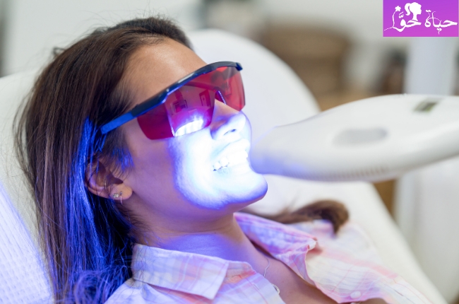 تبييض الاسنان بالليزر Laser teeth whitening