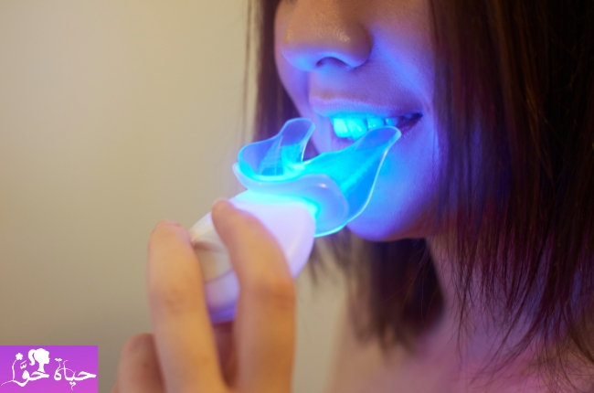 تبييض الاسنان بالليزر Laser teeth whitening