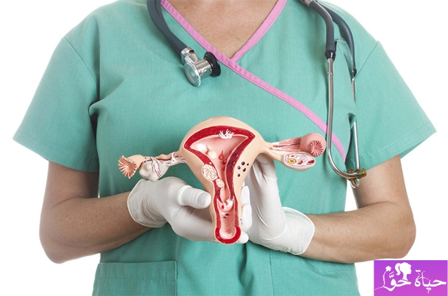تجربتي مع استئصال الرحم My experience with a hysterectomy