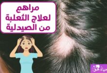 مراهم لعلاج الثعلبة Ointments for the treatment of alopecia