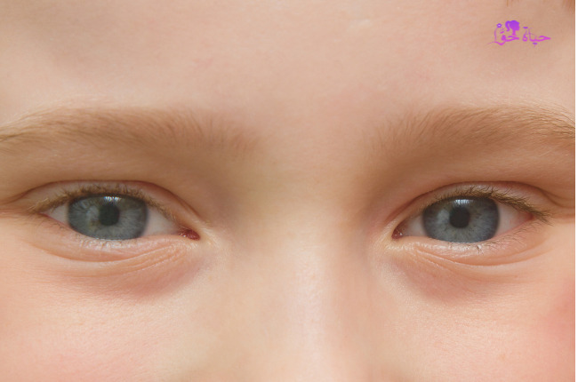 مراحل تغير لون عين الطفل بالصور