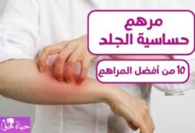 مرهم حساسية الجلد ointment for skin allergy