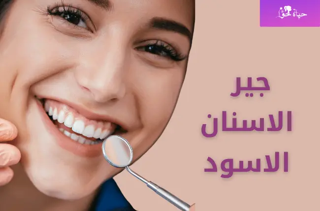 جير الاسنان الاسود Black dental tartar