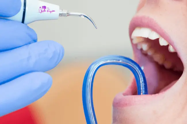 علاج جير الاسنان الاسود 