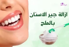 ازالة جير الاسنان بالملح Tooth tartar removal using salt