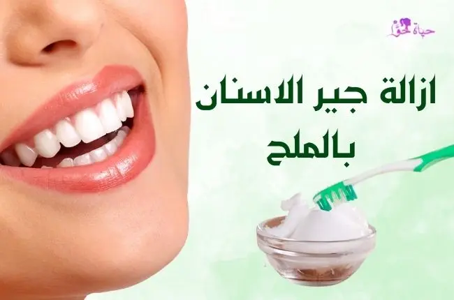 ازالة جير الاسنان بالملح Tooth tartar removal using salt