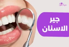 جير الاسنان Tooth tartar